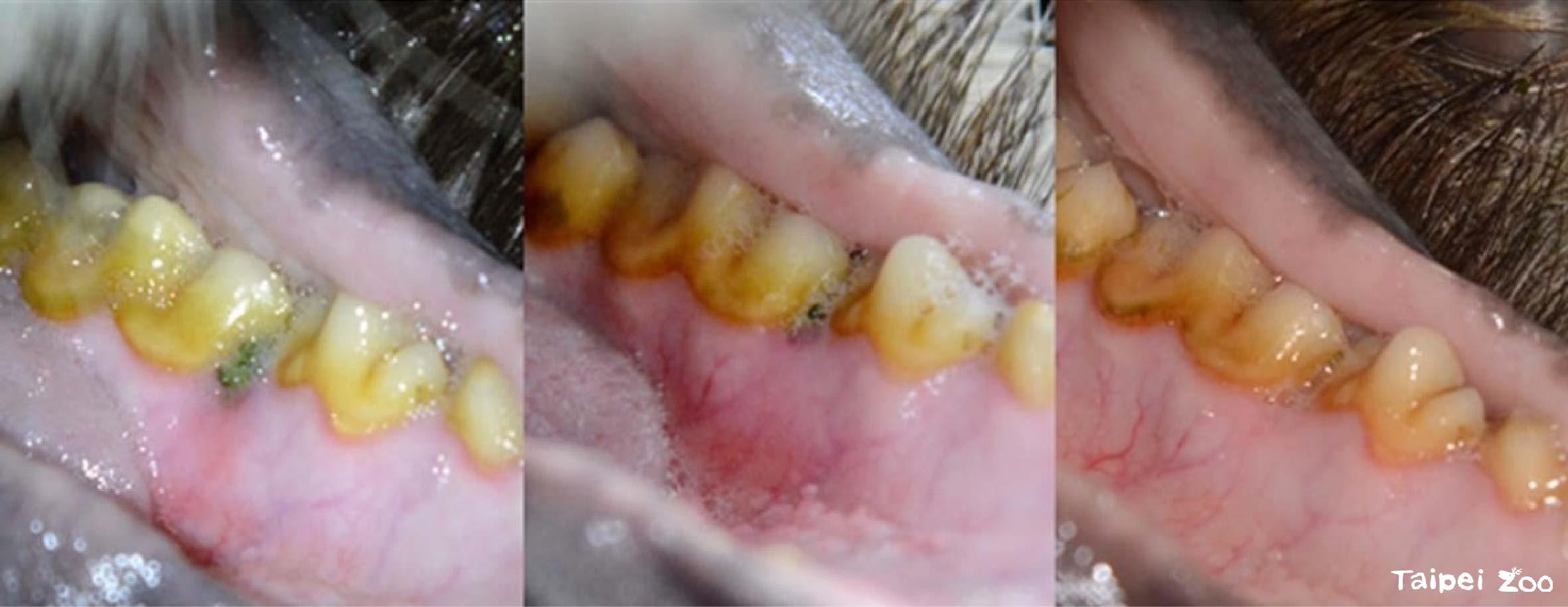 圖2、大貓熊圓圓牙齦形成牙周囊袋，導致食物殘渣持續卡入囊袋(圖中綠色區域)造成局部發炎，於首次手術移除殘渣後仍不見改善。經過後續兩次手術降低牙周囊袋高度，並移除部分結締組織，搭配術後短期特殊食譜護理，與日常刷牙訓練清潔，牙科專科照養上漸趨穩定。(由左至右)(1)異物使局部牙齦發炎 (2)初次手術移除後 (3)手術配合刷牙訓練後狀況改善。照片來源：本研究計畫成果報告